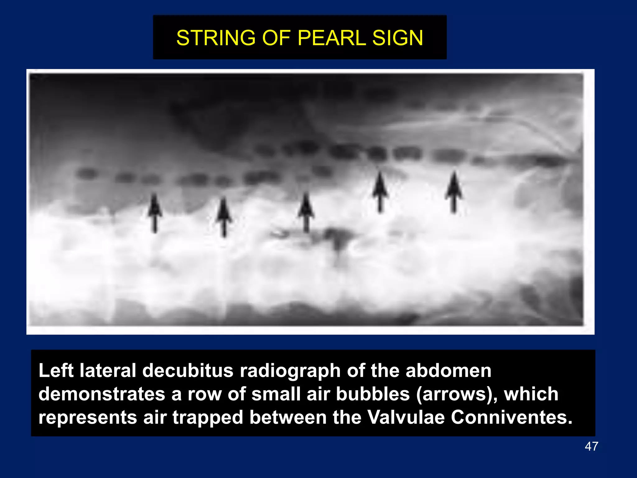 Pictures of acute abdomen.pdf