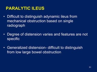 Pictures of acute abdomen.pdf