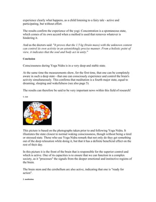 Kreatives Bild zu Pictures of the brain's activity during Yoga Nidra Pictures of the brain's activity during Yoga Nidra