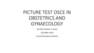 PICTURE TEST OSCE IN
OBSTETRICS AND
GYNAECOLOGY
DROKECHUKWUA.UGWU
DRJUBRIL KUKU
DREZENWANKWOFRANCIS
 