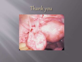 Severe infection (in patient)
Ceftriaxone 2 g i.v. + i.v./oral doxycycline 100
mg twice daily + i.v. metronidazole 500 mg
twice daily.
This should be continued until the patient gets
clinically better which is usually within 24
hours, following which the antibiotics should
be changed to oral therapy for 14 days.
 