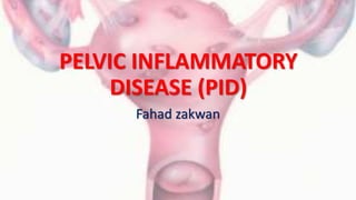 PELVIC INFLAMMATORY
DISEASE (PID)
Fahad zakwan
 
