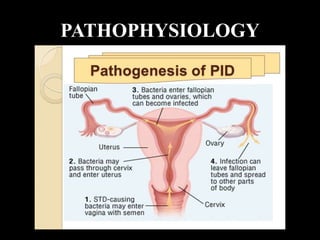 PATHOPHYSIOLOGY
 