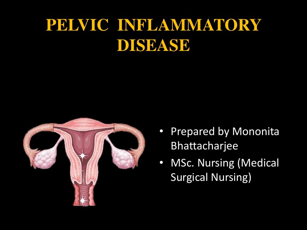 Pelvic inflammatory disease