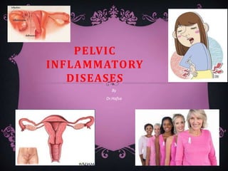 PELVIC
INFLAMMATORY
DISEASES
By
Dr.Hafsa
 