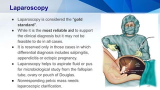 Laparoscopy
24
● Laparoscopy is considered the "gold
standard".
● While it is the most reliable aid to support
the clinical diagnosis but it may not be
feasible to do in all cases.
● It is reserved only in those cases in which
differential diagnosis includes salpingitis,
appendicitis or ectopic pregnancy.
● Laparoscopy helps to aspirate fluid or pus
for microbiological study from the fallopian
tube, ovary or pouch of Douglas.
● Nonresponding pelvic mass needs
laparoscopic clarification.
 