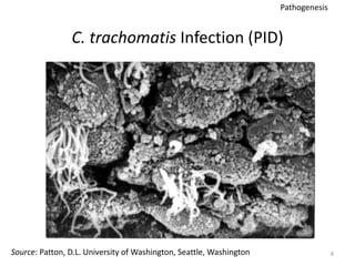 C. trachomatis Infection (PID)
8
Source: Patton, D.L. University of Washington, Seattle, Washington
Pathogenesis
 