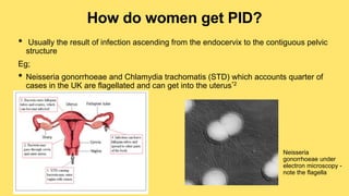 How do women get PID?
• Usually the result of infection ascending from the endocervix to the contiguous pelvic
structure
Eg;
• Neisseria gonorrhoeae and Chlamydia trachomatis (STD) which accounts quarter of
cases in the UK are flagellated and can get into the uterus*2
Neisseria
gonorrhoeae under
electron microscopy -
note the flagella
 
