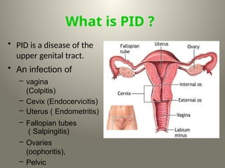 What is PID ?
• PID is a disease of the
upper genital tract.
• An infection of
– vagina
(Colpitis)
– Cevix (Endocervicitis)
– Uterus ( Endometritis)
– Fallopian tubes
( Salpingitis)
– Ovaries
(oophoritis),
– Pelvic
 