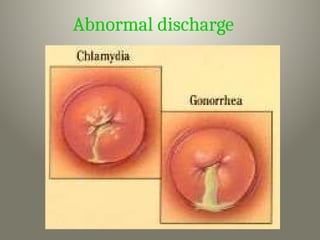 Abnormal discharge
 