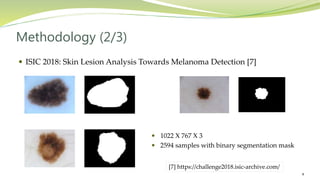 Automatic Skin Lesion Segmentation and Melanoma Detection: Transfer ...