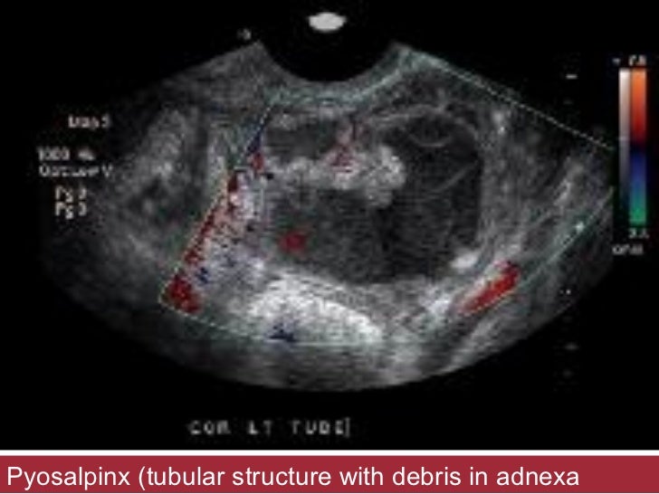 vs hiv oral swab blood test Pid naz dr shabnam by vs hiv oral swab blood test Pid naz dr shabnam by