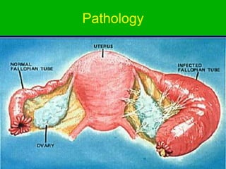 Pathology
 