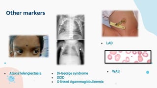 Other markers
● AtaxiaTelengiectasia ● Di-George syndrome
● SCID
● X-linked Agammaglobulinemia
● WAS
● LAD
 
