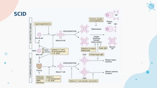 SCID
 