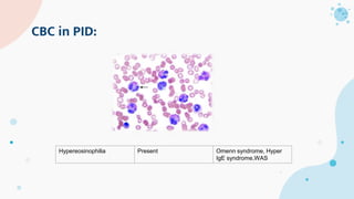 CBC in PID:
Hypereosinophilia Present Omenn syndrome, Hyper
IgE syndrome,WAS
 