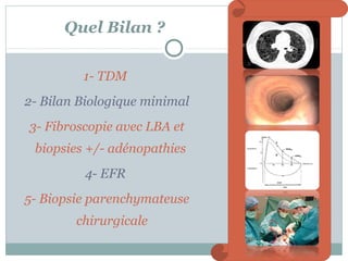 Quel Bilan ?
1- TDM
2- Bilan Biologique minimal
3- Fibroscopie avec LBA et
biopsies +/- adénopathies
4- EFR
5- Biopsie parenchymateuse
chirurgicale

 