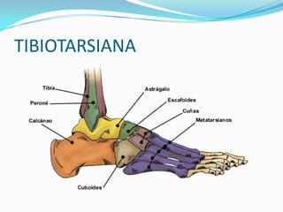 TIBIOTARSIANA

 
