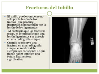 Fracturas del tobillo
 EI anillo puede romperse no
solo por la lesión de los
huesos (que produce
fracturas), sino también por la
lesión de los ligamentos.
 AI contrario que las fracturas
óseas, es improbable que una
lesión ligamentosa se aprecie
en una radiografía simple.
 Cuando se observa una
fractura en una radiografía
simple, el medico debe
siempre ser consciente de que
puede haber también una
rotura ligamentosa
significativa.
 