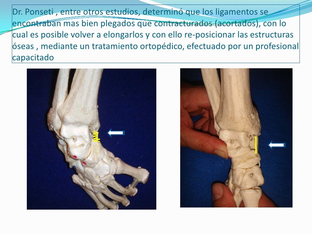 Pie Bot Información a la Familia