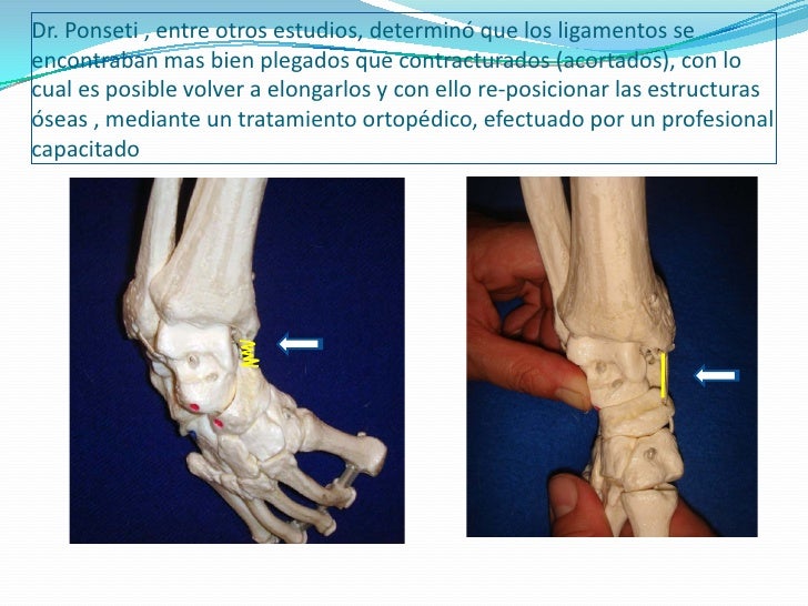 Pie Bot Información a la Familia