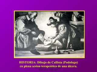 Dr. Eugenio José Vargas Carbajal
CMP 11161 - RNE 4368
HISTORIA: Dibujo de Callista (Podologo)
en plena sesion terapeútica de una úlcera.
 