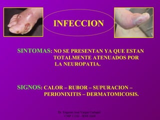 Dr. Eugenio José Vargas Carbajal
CMP 11161 - RNE 4368
INFECCION
SINTOMAS: NO SE PRESENTAN YA QUE ESTAN
TOTALMENTE ATENUADOS POR
LA NEUROPATIA.
SIGNOS: CALOR – RUBOR – SUPURACION –
PERIONIXITIS – DERMATOMICOSIS.
 
