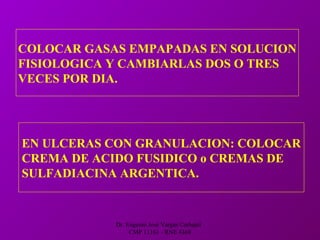 Dr. Eugenio José Vargas Carbajal
CMP 11161 - RNE 4368
COLOCAR GASAS EMPAPADAS EN SOLUCION
FISIOLOGICA Y CAMBIARLAS DOS O TRES
VECES POR DIA.
EN ULCERAS CON GRANULACION: COLOCAR
CREMA DE ACIDO FUSIDICO o CREMAS DE
SULFADIACINA ARGENTICA.
 