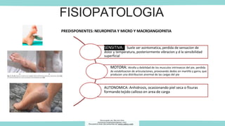 FISIOPATOLOGIA
SENSITIVA: Suele ser asintomatica, perdida de sensacion de
dolor y temperatura, posteriormente vibracion y d la sensibilidad
superficial
MOTORA: Atrofia y debilidad de los musculos intrinsecos del pie, perdida
de estabilizacion de articulaciones, provovando dedos en martillo y garra, que
producen una distribucion anormal de las cargas del pie
AUTONOMICA: Anhidrosis, ocasionando piel seca o fisuras
formando tejido calloso en area de carga
PREDISPONENTES: NEUROPATIA Y MICRO Y MACROANGIOPATIA
Descargado por Marcela Diaz
(jennymarceladiazdiaz@gmail.com)
Encuentra más documentos en www.udocz.com
 
