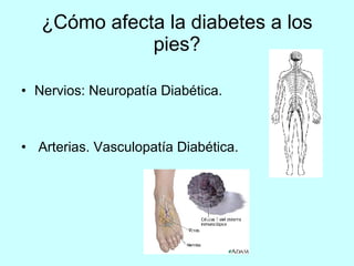 ¿Cómo afecta la diabetes a los pies? Nervios: Neuropatía Diabética. Arterias. Vasculopatía Diabética. 