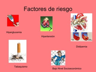 Factores de riesgo Hiperglucemia Hipertensión Tabaquismo Bajo Nivel Socioeconómico Dislipemia 