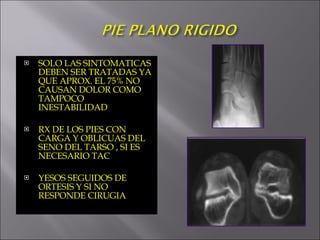 SOLO LAS SINTOMATICAS DEBEN SER TRATADAS YA QUE APROX. EL 75% NO CAUSAN DOLOR COMO TAMPOCO INESTABILIDAD RX DE LOS PIES CON CARGA Y OBLICUAS DEL SENO DEL TARSO , SI ES NECESARIO TAC YESOS SEGUIDOS DE ORTESIS Y SI NO RESPONDE CIRUGIA