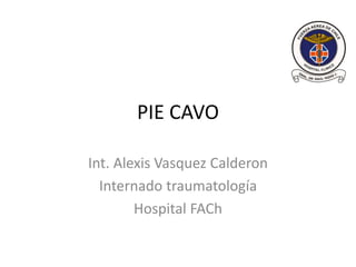 PIE CAVO
Int. Alexis Vasquez Calderon
Internado traumatología
Hospital FACh
 