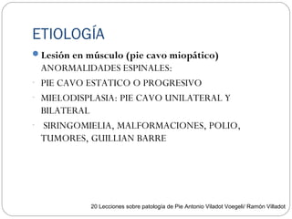 ETIOLOGÍA
Lesión en músculo (pie cavo miopático)
ANORMALIDADES ESPINALES:
- PIE CAVO ESTATICO O PROGRESIVO
- MIELODISPLASIA: PIE CAVO UNILATERAL Y
BILATERAL
- SIRINGOMIELIA, MALFORMACIONES, POLIO,
TUMORES, GUILLIAN BARRE
20 Lecciones sobre patología de Pie Antonio Viladot Voegeli/ Ramón Villadot
 