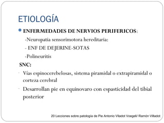 ETIOLOGÍA
ENFERMEDADES DE NERVIOS PERIFERICOS:
-Neuropatia sensorimotora hereditaria:
- ENF DE DEJERINE-SOTAS
-Polineuritis
SNC:
- Vías espinocerebelosas, sistema piramidal o extrapiramidal o
corteza cerebral
- Desarrollan pie en equinovaro con espasticidad del tibial
posterior
20 Lecciones sobre patología de Pie Antonio Viladot Voegeli/ Ramón Villadot
 