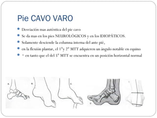 Pie CAVO VARO
 Desviación mas auténtica del pie cavo
 Se da mas en los pies NEUROLÓGICOS y en los IDIOPÁTICOS.
 Solamente desciende la columna interna del ante pié,
 en la flexión plantar, el 1°y 2° MTT adquieren un ángulo notable en equino
 ◦ en tanto que el del 5° MTT se encuentra en un posición horizontal normal
 