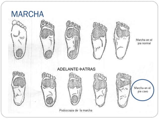MARCHA
ADELANTEATRAS
 