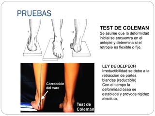 PRUEBAS
TEST DE COLEMAN
Se asume que la deformidad
inicial se encuentra en el
antepie y determina si el
retropie es flexible o fijo.
LEY DE DELPECH
Irreductibilidad se debe a la
retraccion de partes
blandas (reductible)
Con el tiempo la
deformidad ósea se
establece y provoca rigidez
absoluta.
 