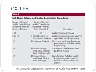 QX- LPB
The Anatomy of Cavus Foot Deformity, Arash Aminian, ET. AL., Foot Anckle Clin N Am 13(2008)
 