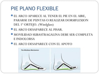 PIE PLANO FLEXIBLE
EL ARCO APARECE AL TENER EL PIE EN EL AIRE,
PARARSE DE PUNTAS O REALIZAR DORSIFLEXION
DEL 1º ORTEJO. (Windglass)
EL ARCO DESAPARECE AL PISAR.
MOVILIDAD SUBASTRAGALINA DEBE SER COMPLETA
E INDOLORSA
EL ARCO DESAPARECE CON EL APOYO
 