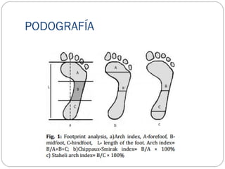PODOGRAFÍA
 