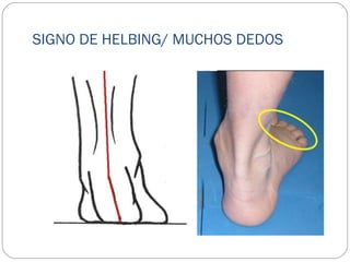 SIGNO DE HELBING/ MUCHOS DEDOS
 