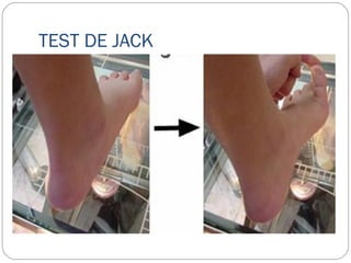 TEST DE JACK
 