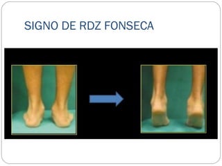 SIGNO DE RDZ FONSECA
 