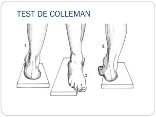 TEST DE COLLEMAN
 