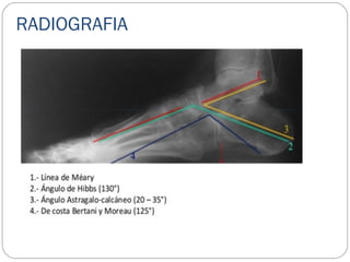 RADIOGRAFIA
 