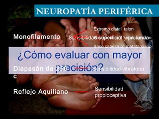 NEUROPATÍA PERIFÉRICA
¿Cómo evaluar con mayor
precisión?
Monofilamento Sensibilidad superficial y profunda
Extremo distal talon
Base cabeza 1° metatarsiano
Base cabeza 5° metatarsiano
Diapasón de 256
c
Sensibilidad vibratoria
Reflejo Aquiliano
Sensibilidad
propioceptiva
 