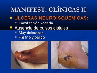  ÚLCERAS NEUROISQUÉMICAS:ÚLCERAS NEUROISQUÉMICAS:
 Localización variadaLocalización variada
 Ausencia de pulsos distalesAusencia de pulsos distales
 Muy dolorosasMuy dolorosas
 Pie frío y pálidoPie frío y pálido
MANIFEST. CLÍNICAS IIMANIFEST. CLÍNICAS II
 