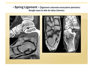 Imagerie du pied et de la cheville