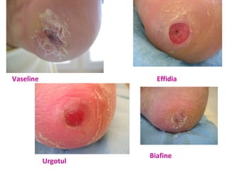 Vaseline Effidia Urgotul Biafine  